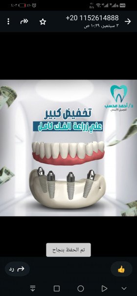 زراعه الأسنان  - عيادة دكتور احمد محسب استشاري تجميل وزراعه الأسنان 